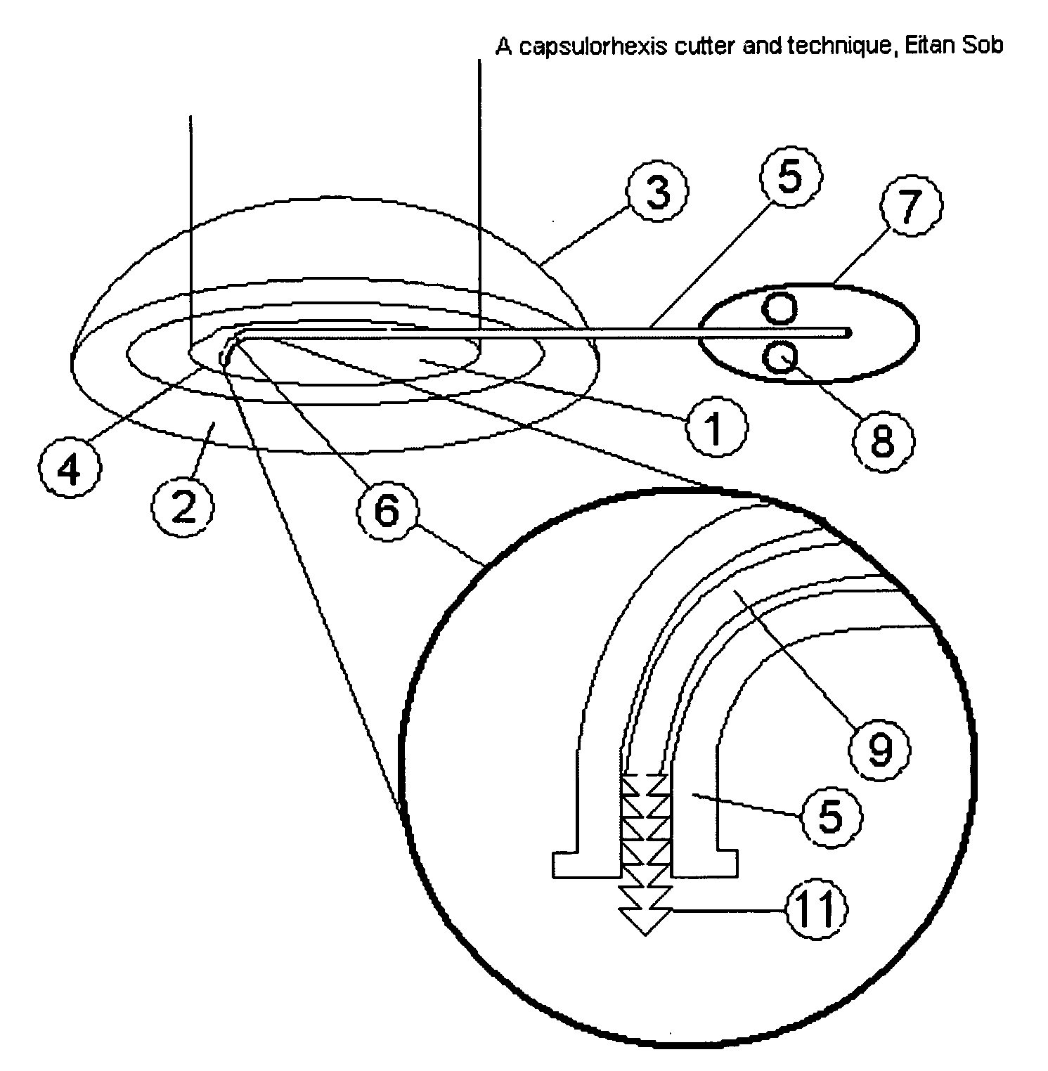 Capsulorhexis cutter and technique