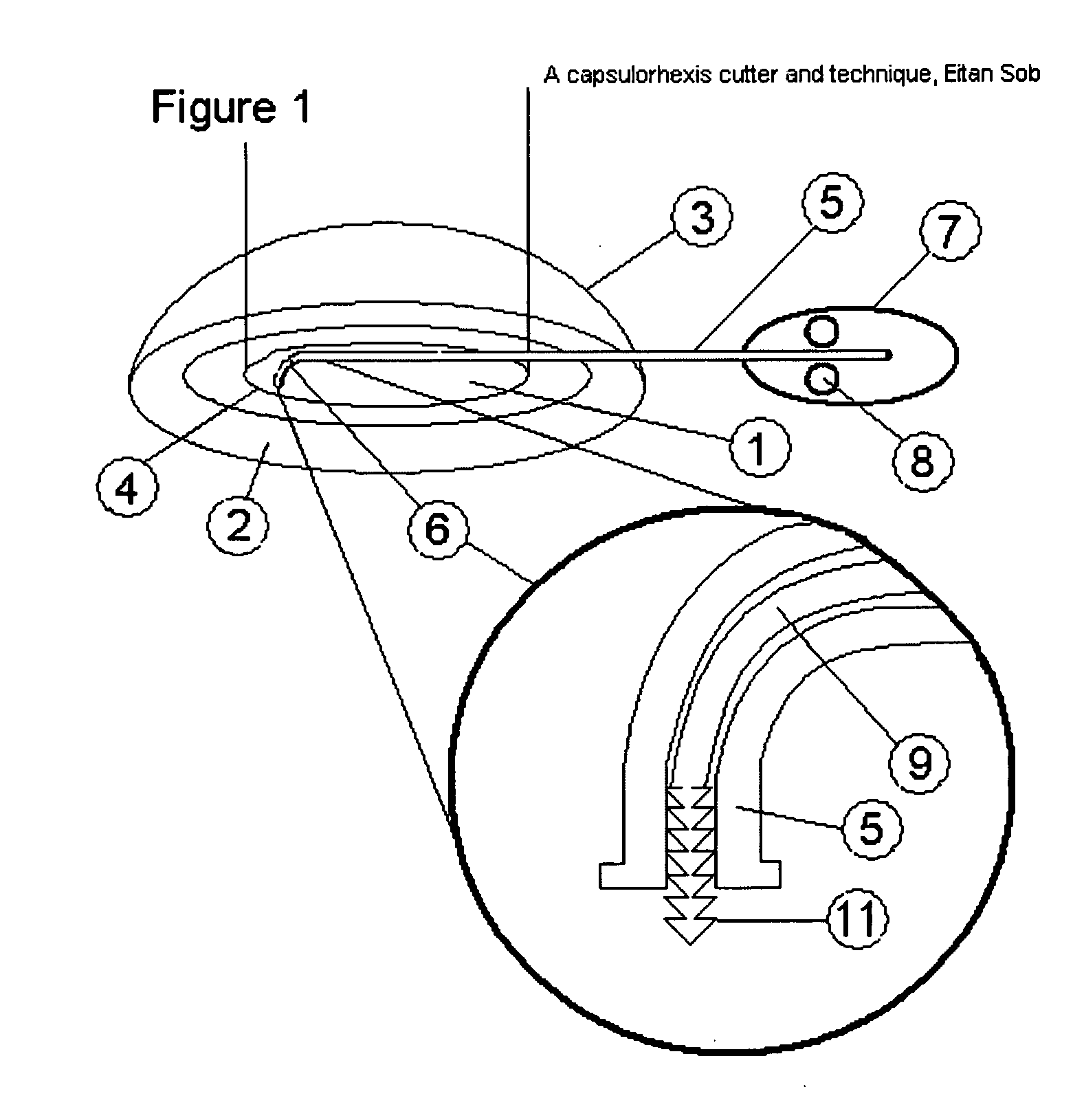 Capsulorhexis cutter and technique