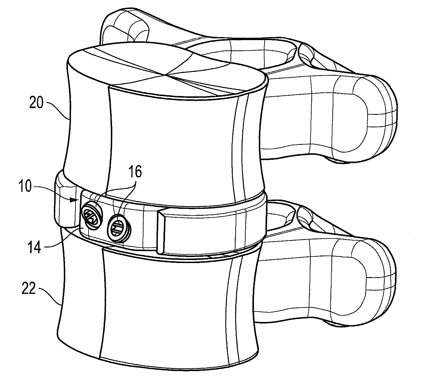 Interbody fusion device with snap on anterior plate and associated methods