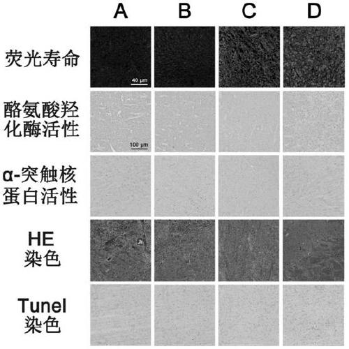 Biological nanocomposite material, and synthesis method and application thereof