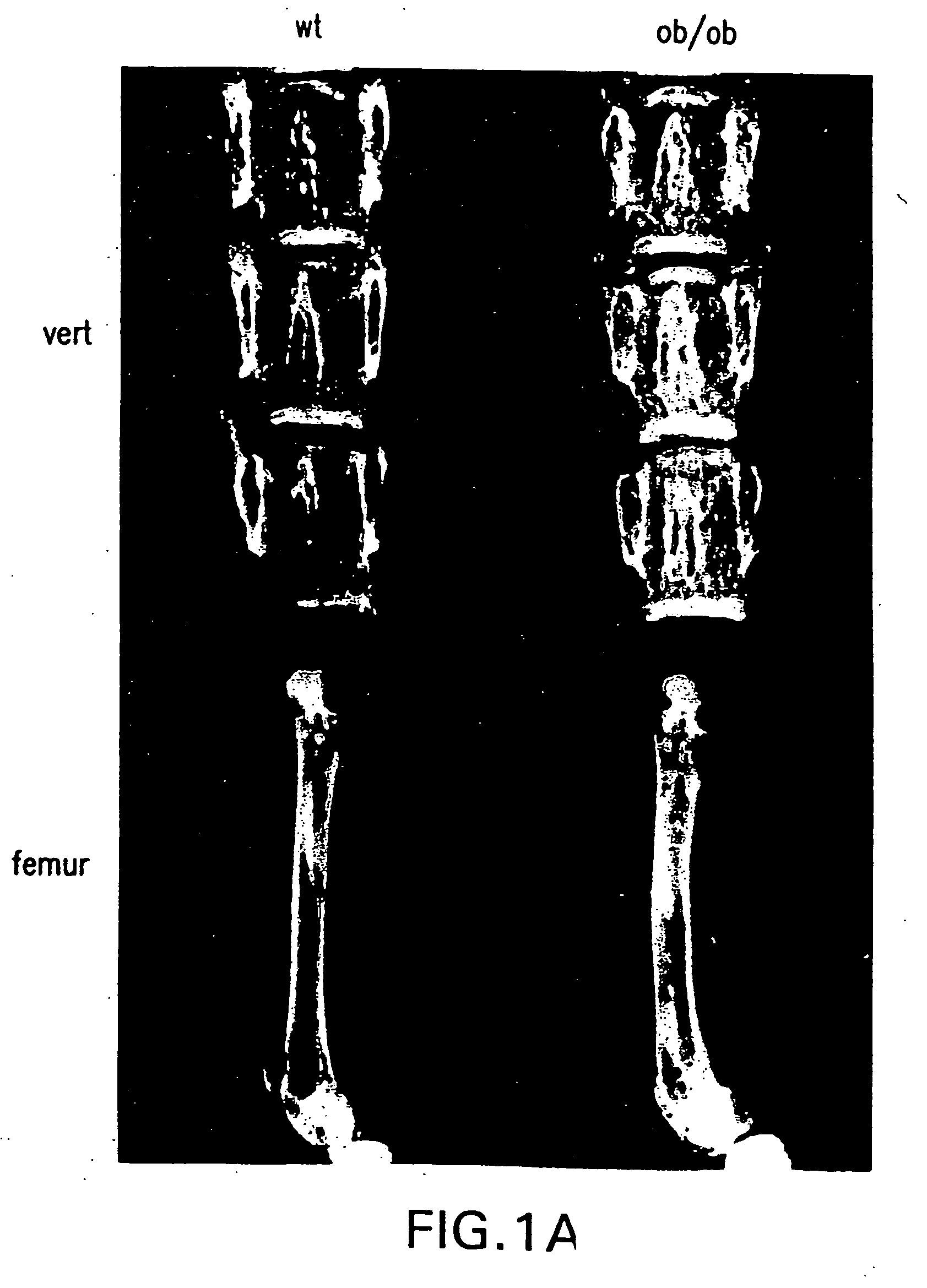 Methods and compositions for control of bone formation via modulation of sympathetic tone