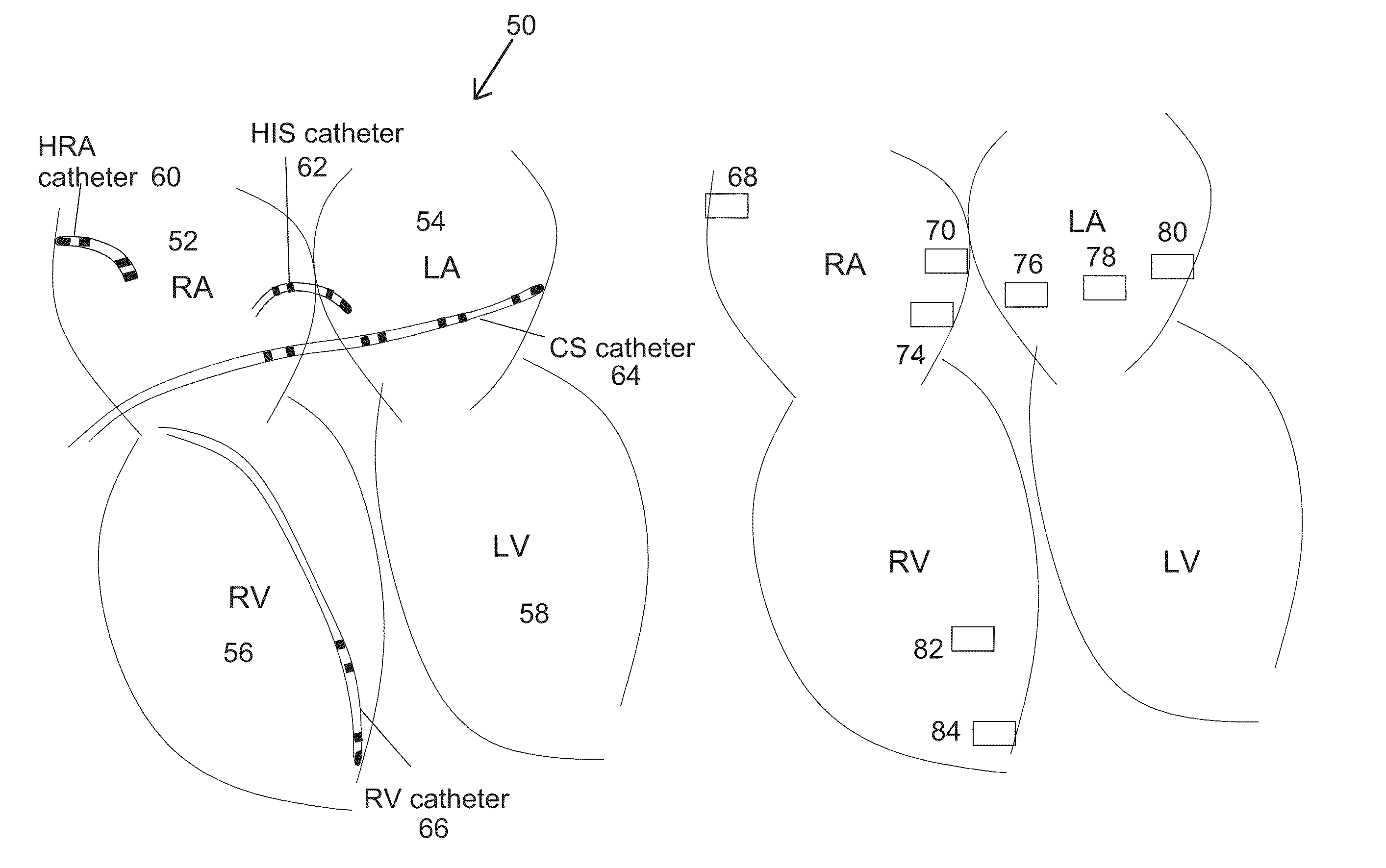 System and methods for real-time cardiac mapping