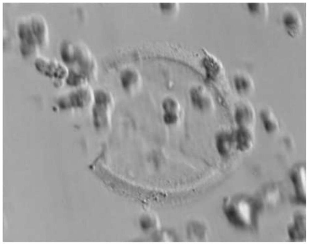 Pathogenic mutation of genetic gametogenesis disorder and detection reagent thereof