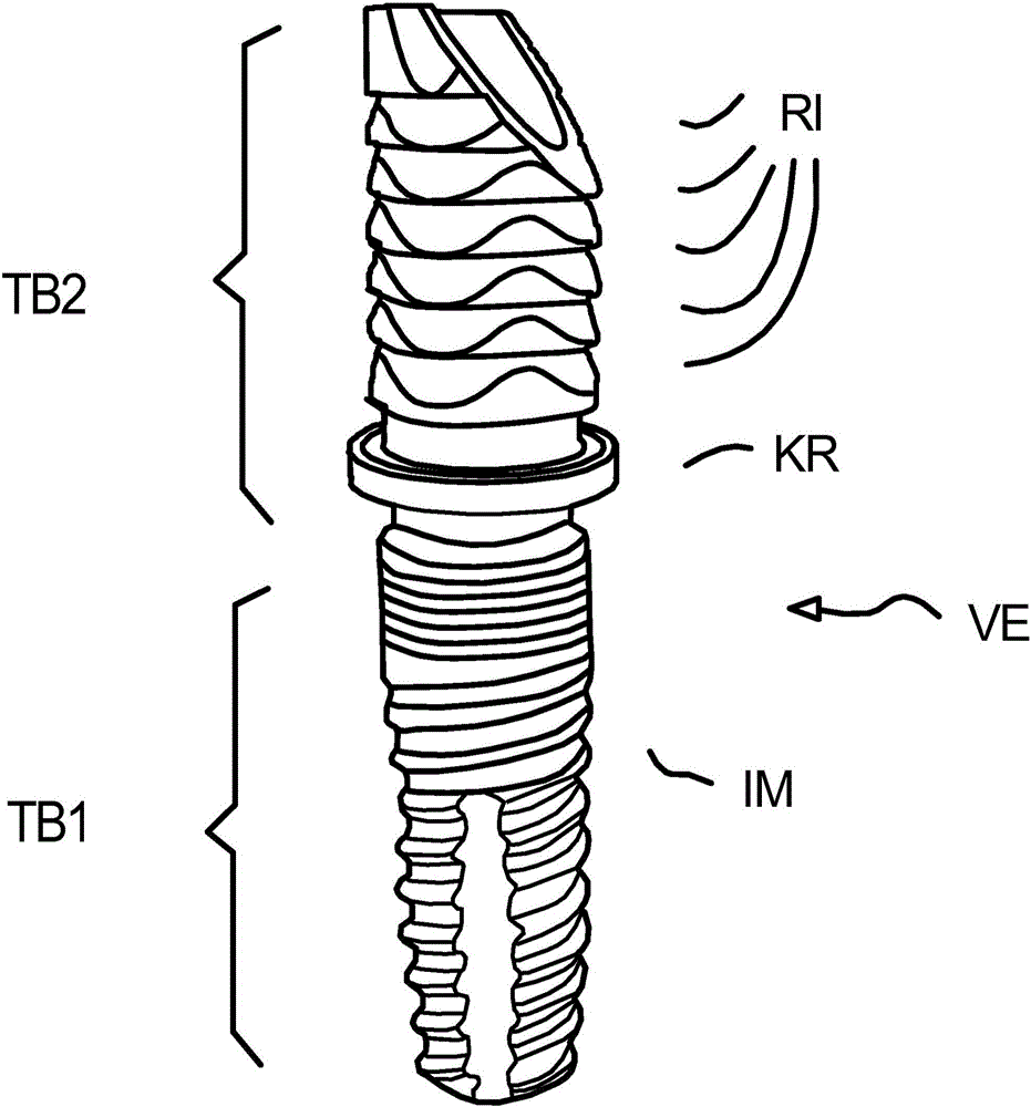 Anchoring element and method for producing same