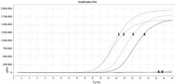 Real-time fluorescent quantitative PCR (polymerase chain reaction) detecting reagent kit for orf virus