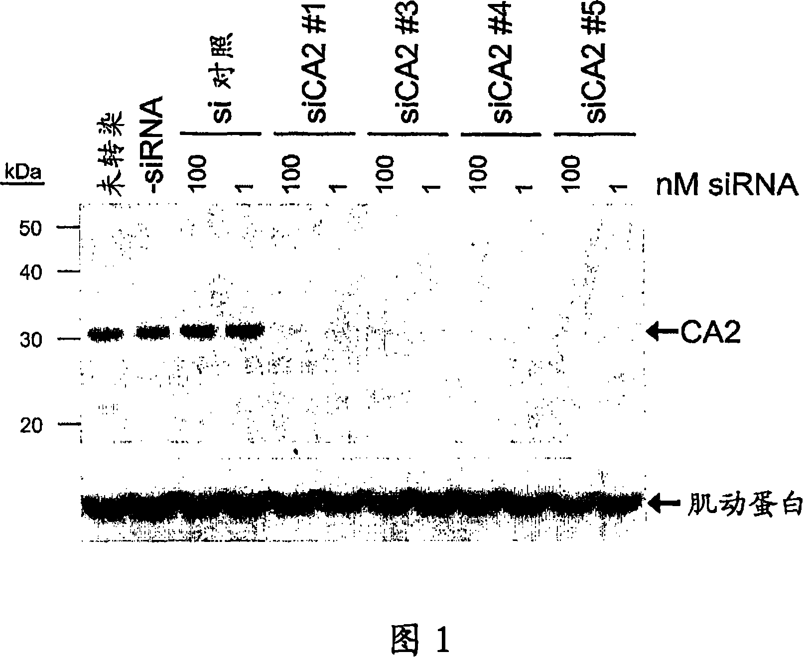 Rnai-mediated inhibition of ocular hypertension targets