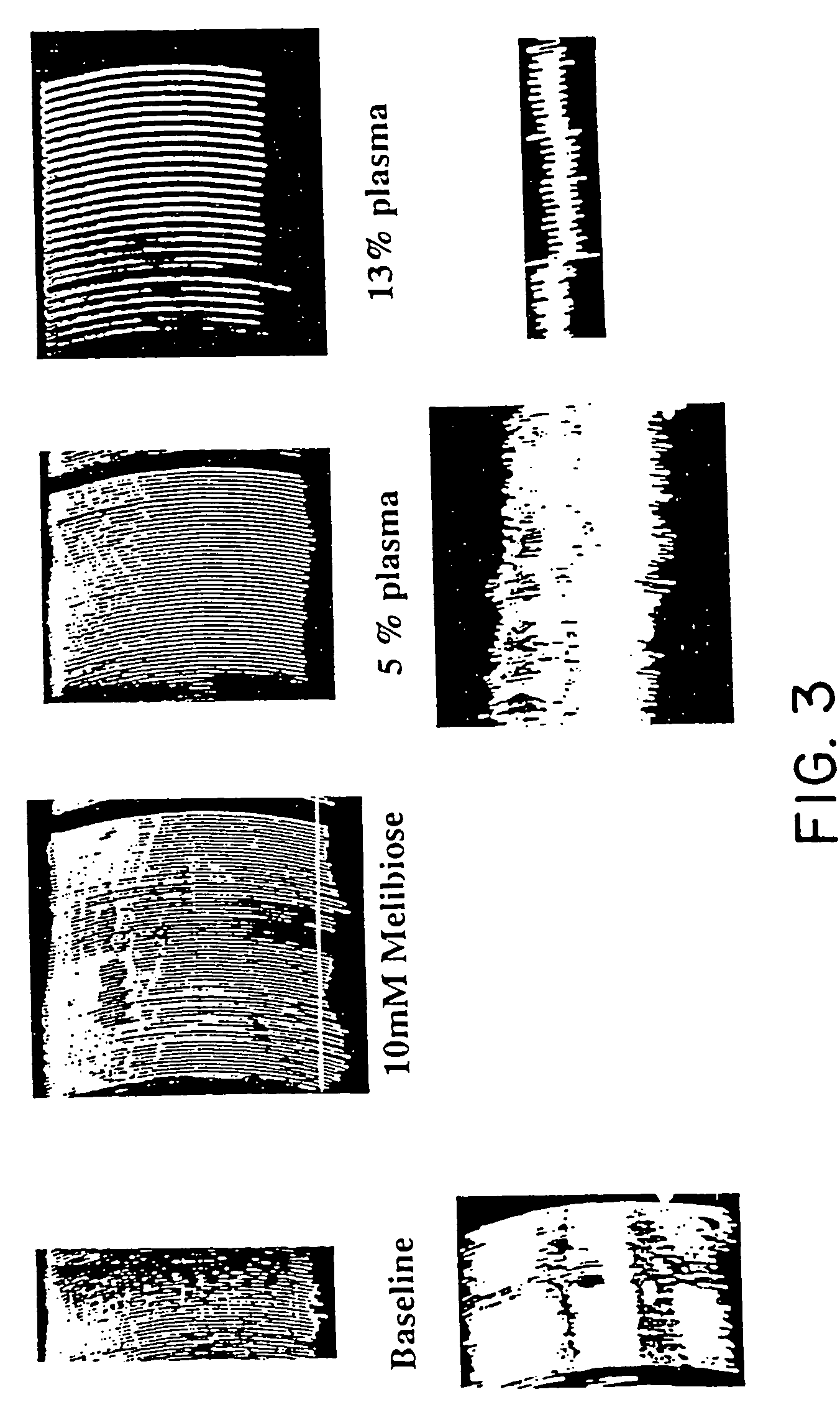 Materials and methods for management of hyperacute rejection in human xenotransplantation