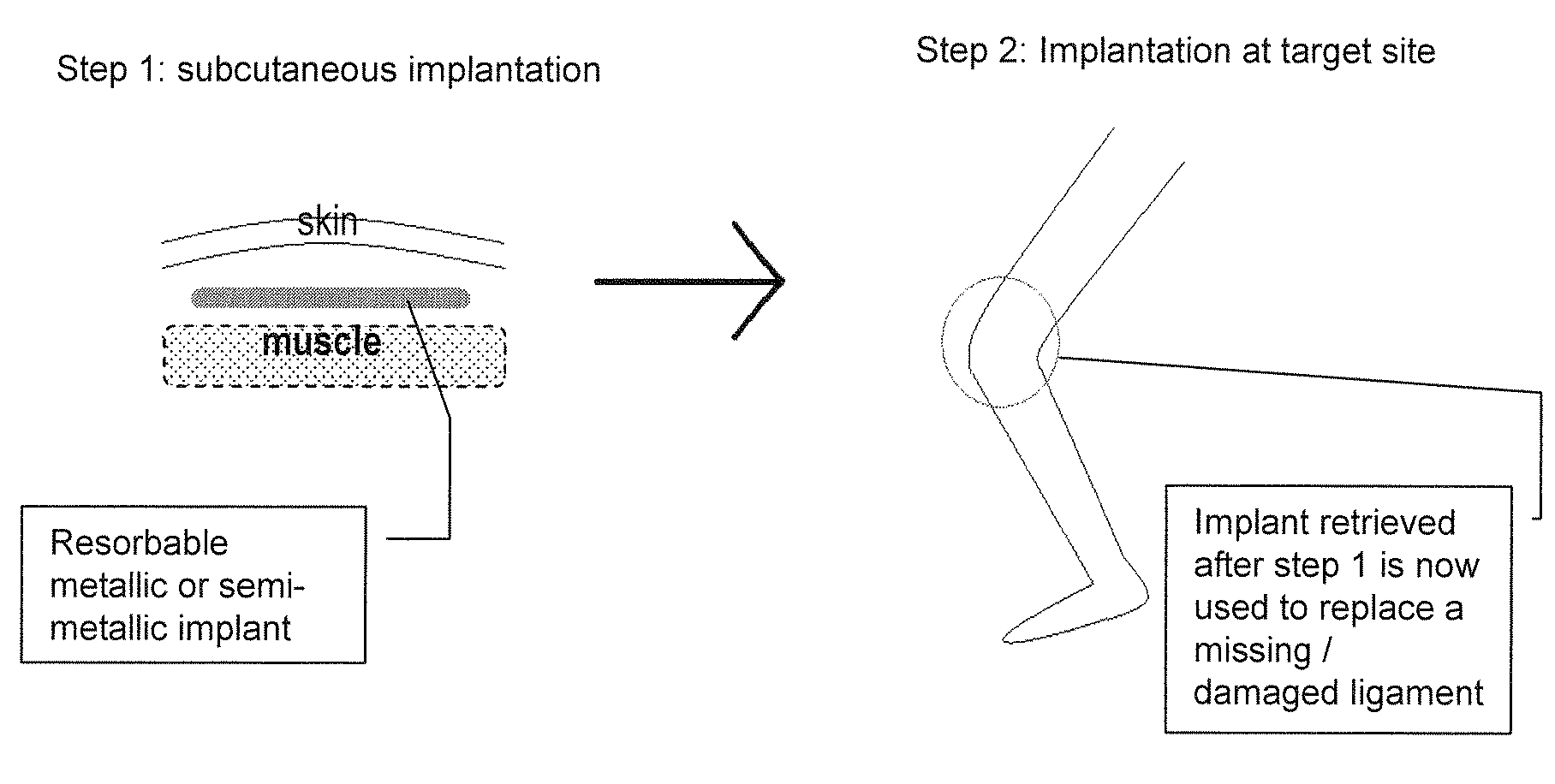 Implant for Tissue Engineering