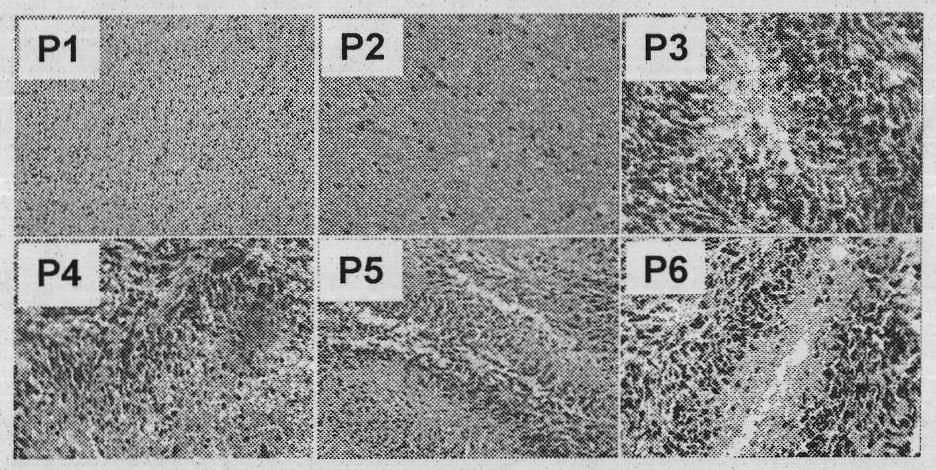 Application of gap junction protein and coding gene thereof in preparing medicament for reversing malignant phenotype of cancer stem cell