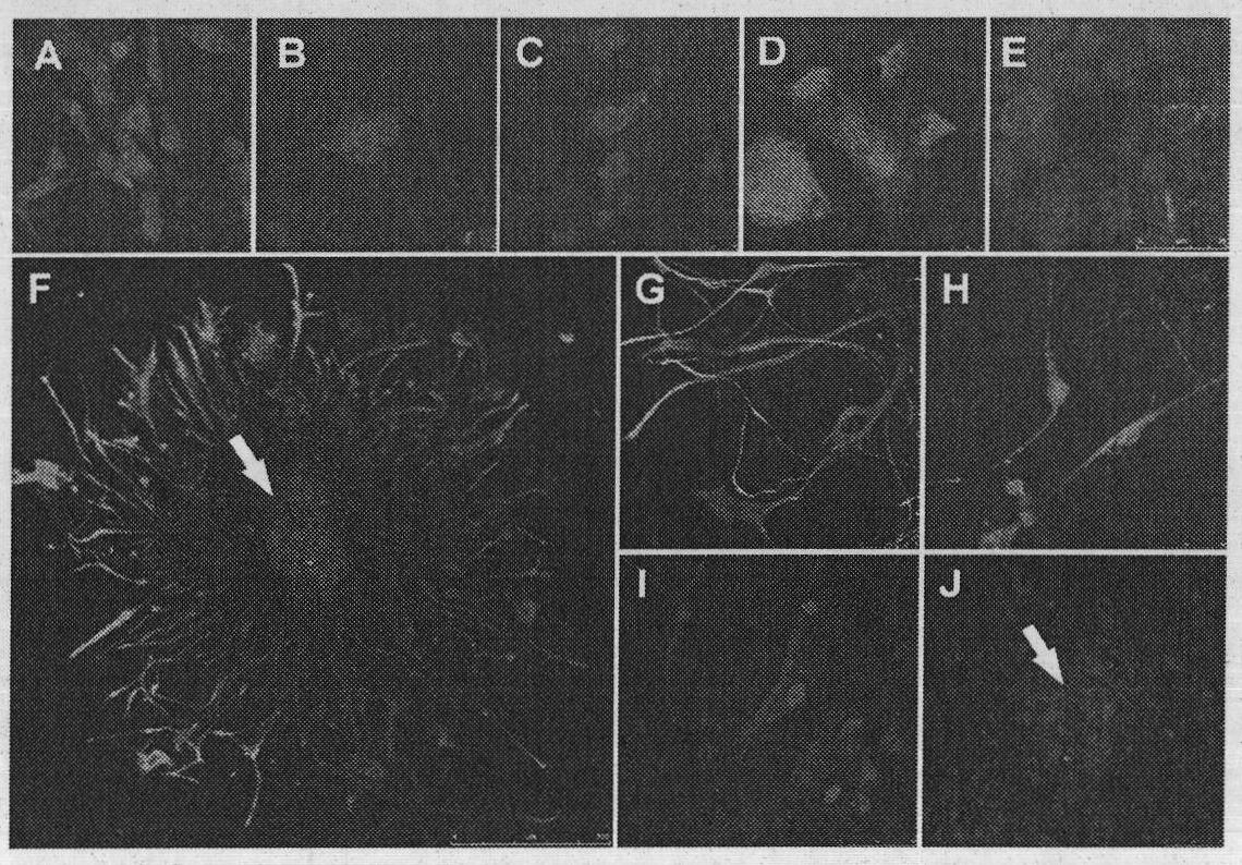 Application of gap junction protein and coding gene thereof in preparing medicament for reversing malignant phenotype of cancer stem cell