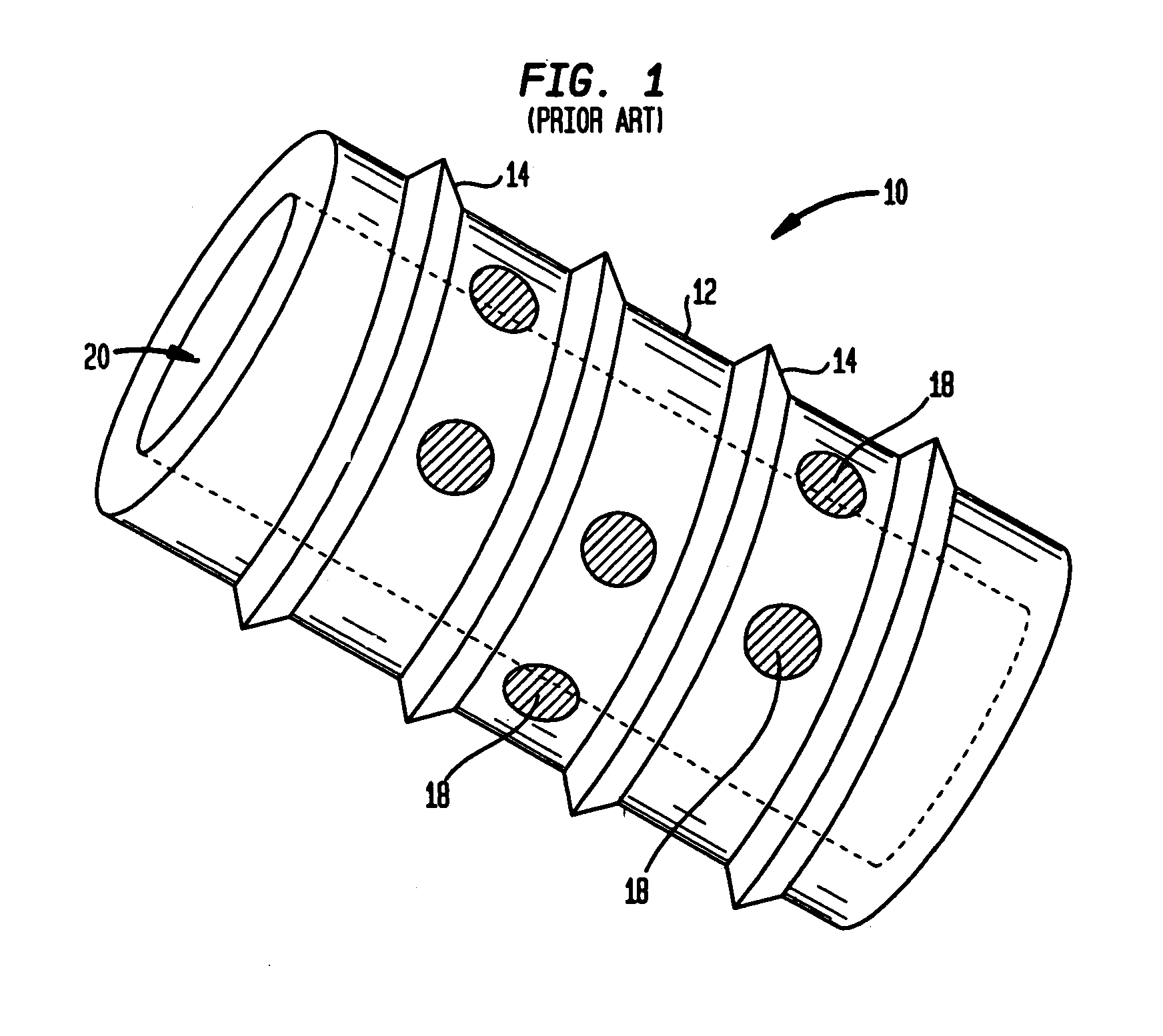 Intervertebral spacer device having a radially thinning belleville spring