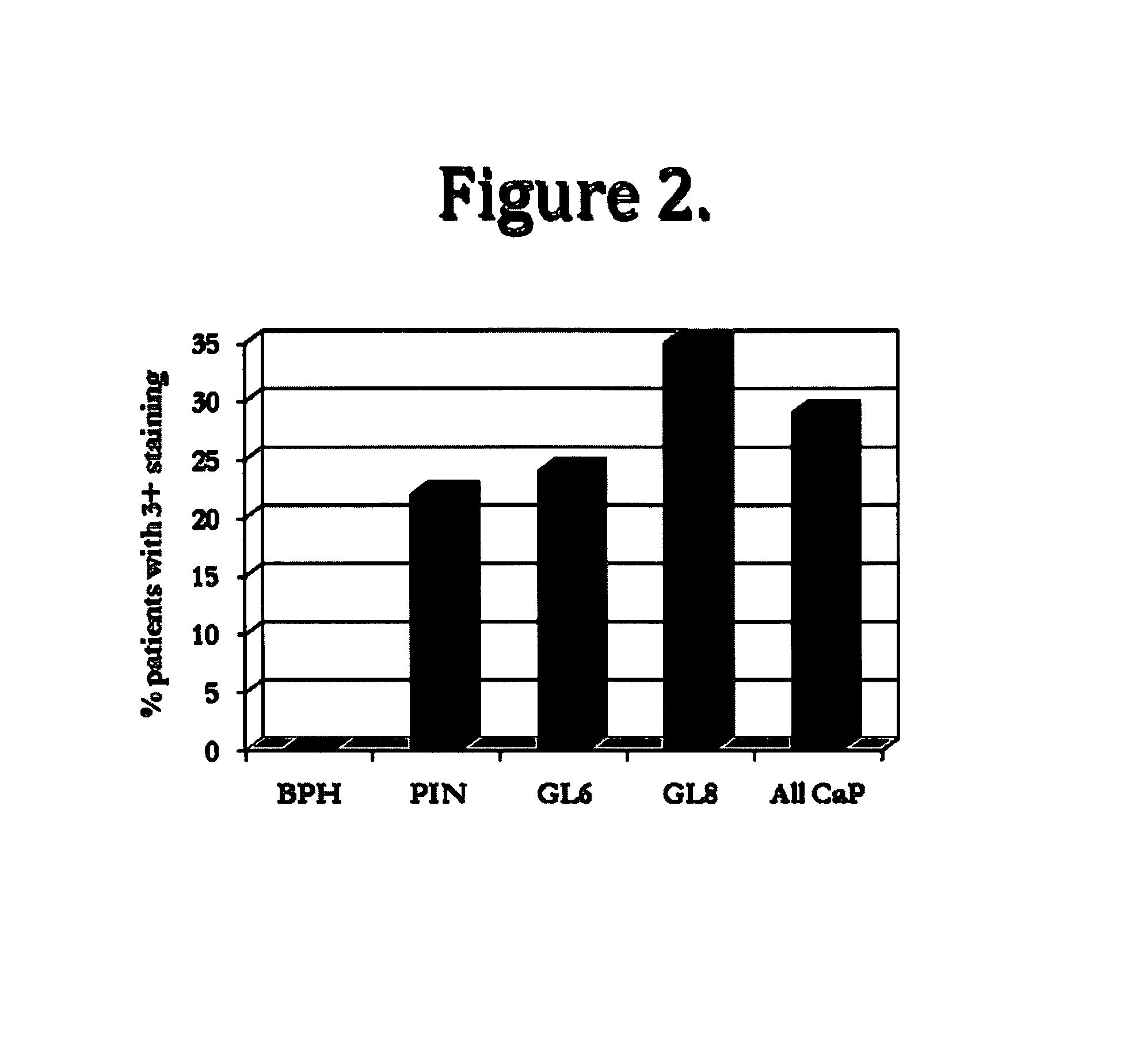 Biomarkers for prostate cancer