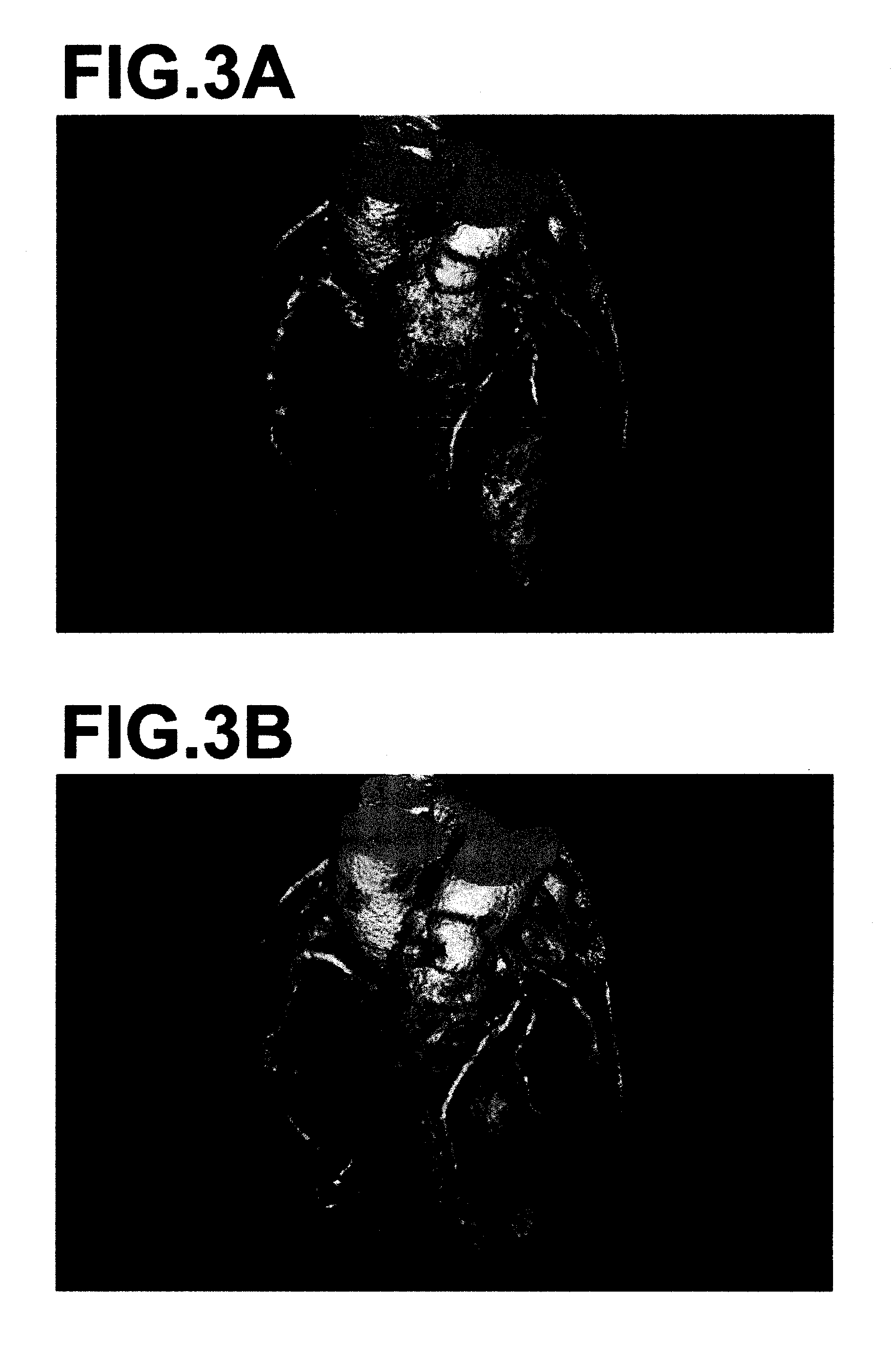 Diagnosis assisting apparatus, coronary artery analyzing method and recording medium having a coronary artery analyzing program stored therein