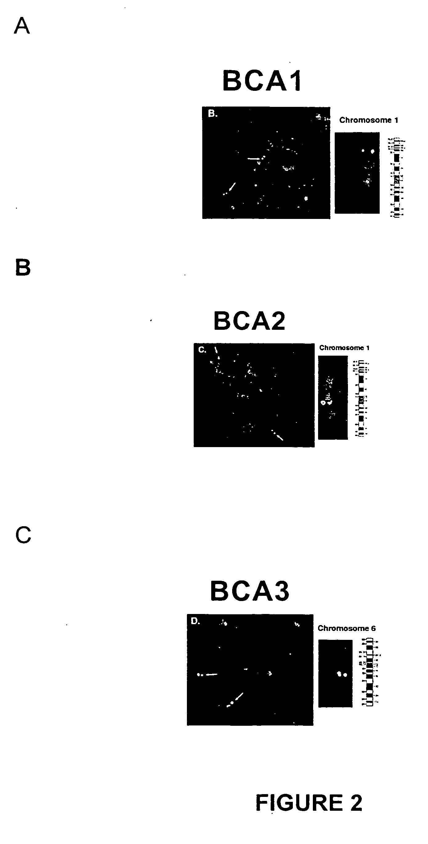 Breast cancer-associated genes and uses thereof