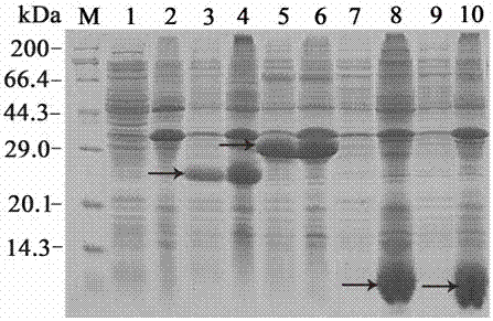 Escherichia coli anti-tumor targeted engineering strain, and building method and application thereof