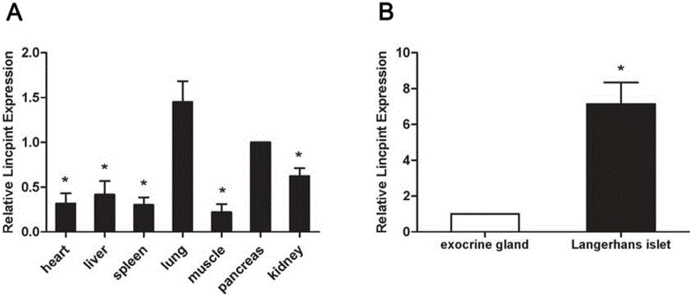 Long non-coding RNA and application thereof in diagnosis and/ or treatment of T2DM