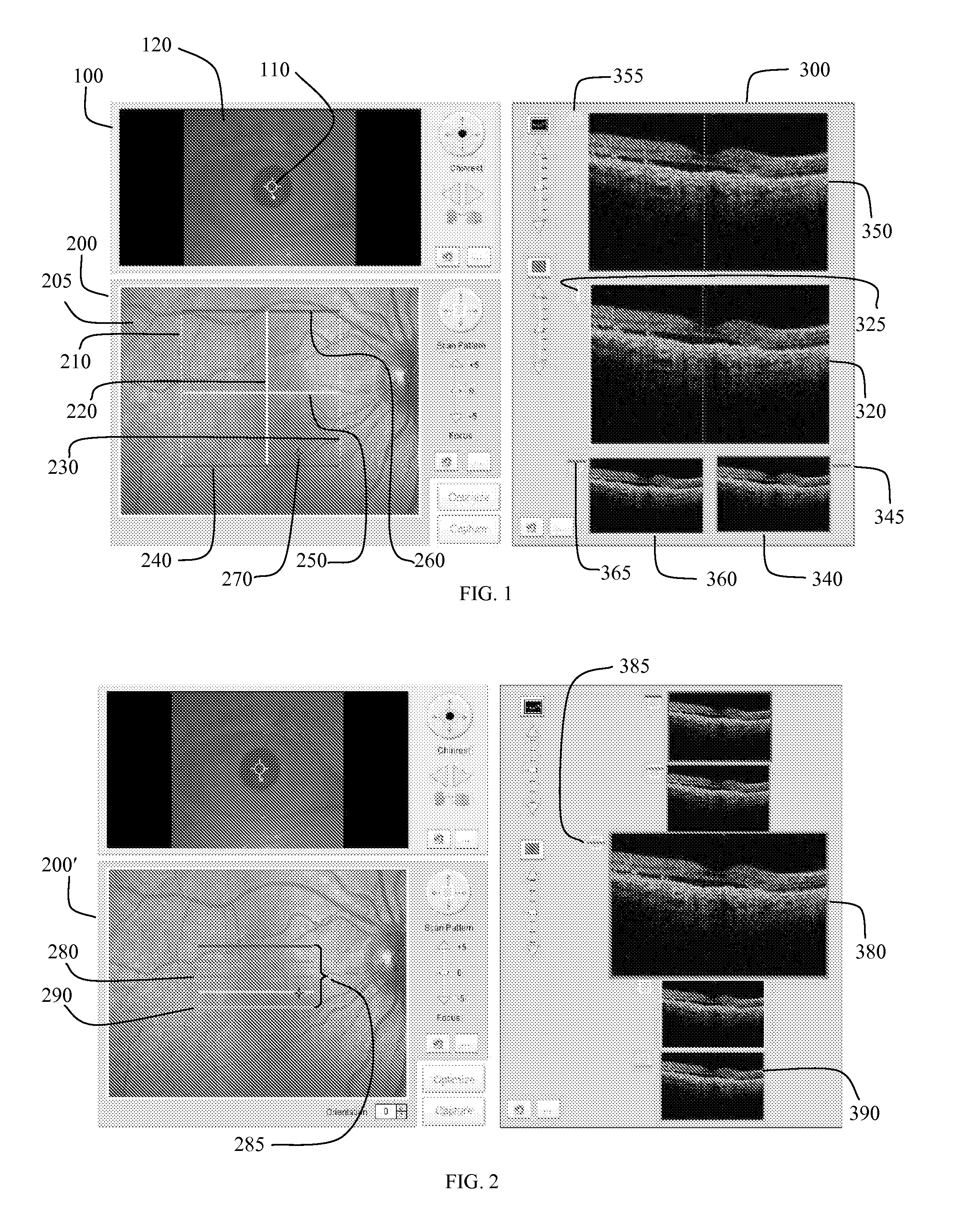 User interface for efficiently displaying relevant oct imaging data