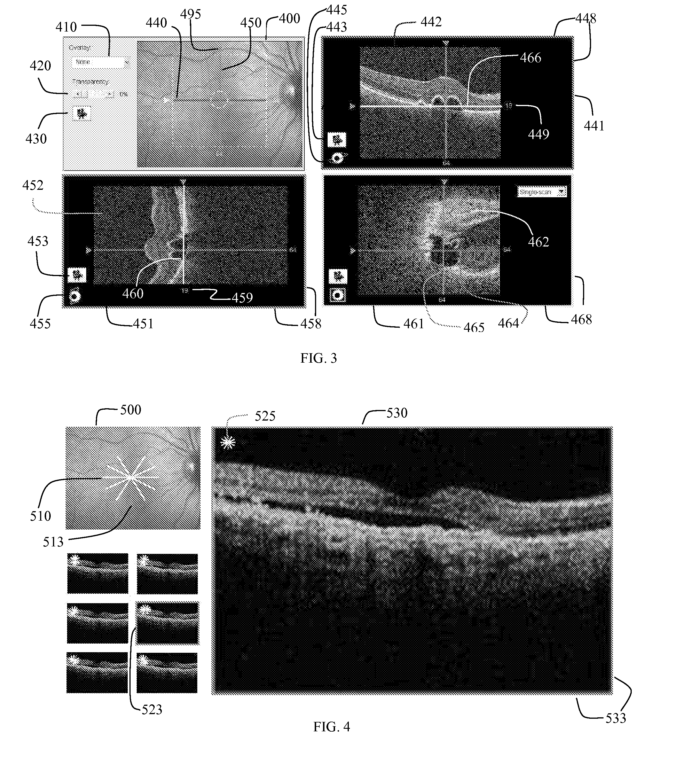 User interface for efficiently displaying relevant oct imaging data