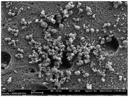 A material used to seal dentinal tubules to desensitize teeth