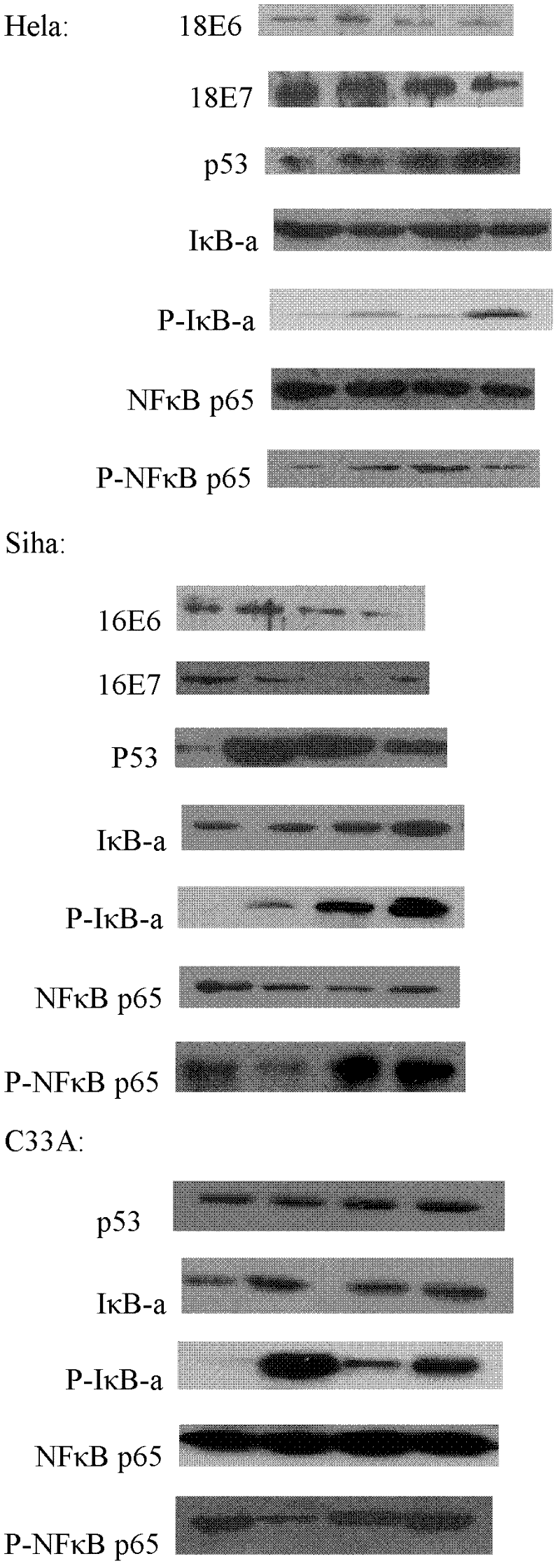 Application of isoquinoline type alkaloids and derivatives thereof to preparation of medicine for inhibiting HPV (Human Papilloma Virus) infection