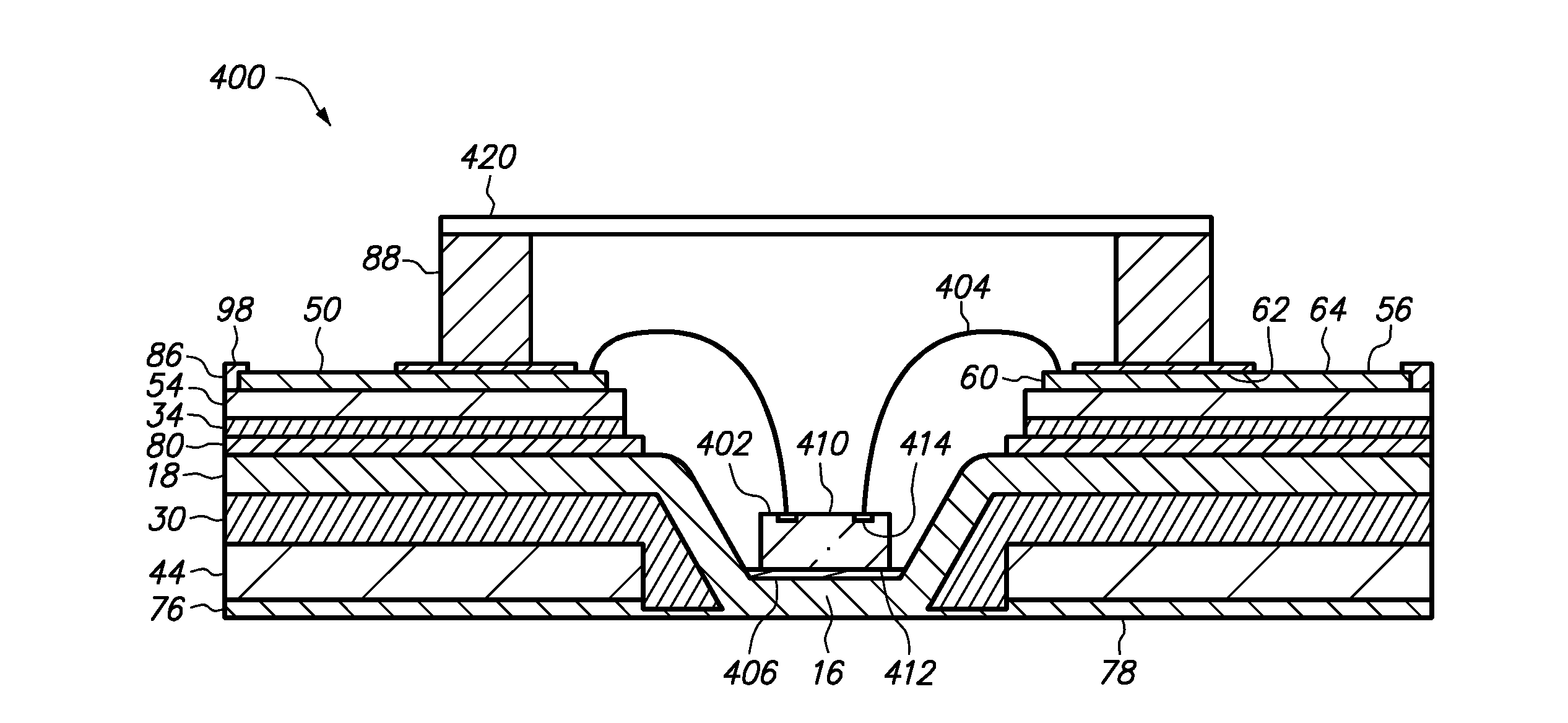 Method of making a semiconductor chip assembly with a bump/base/ledge heat spreader, dual adhesives and a cavity in the bump