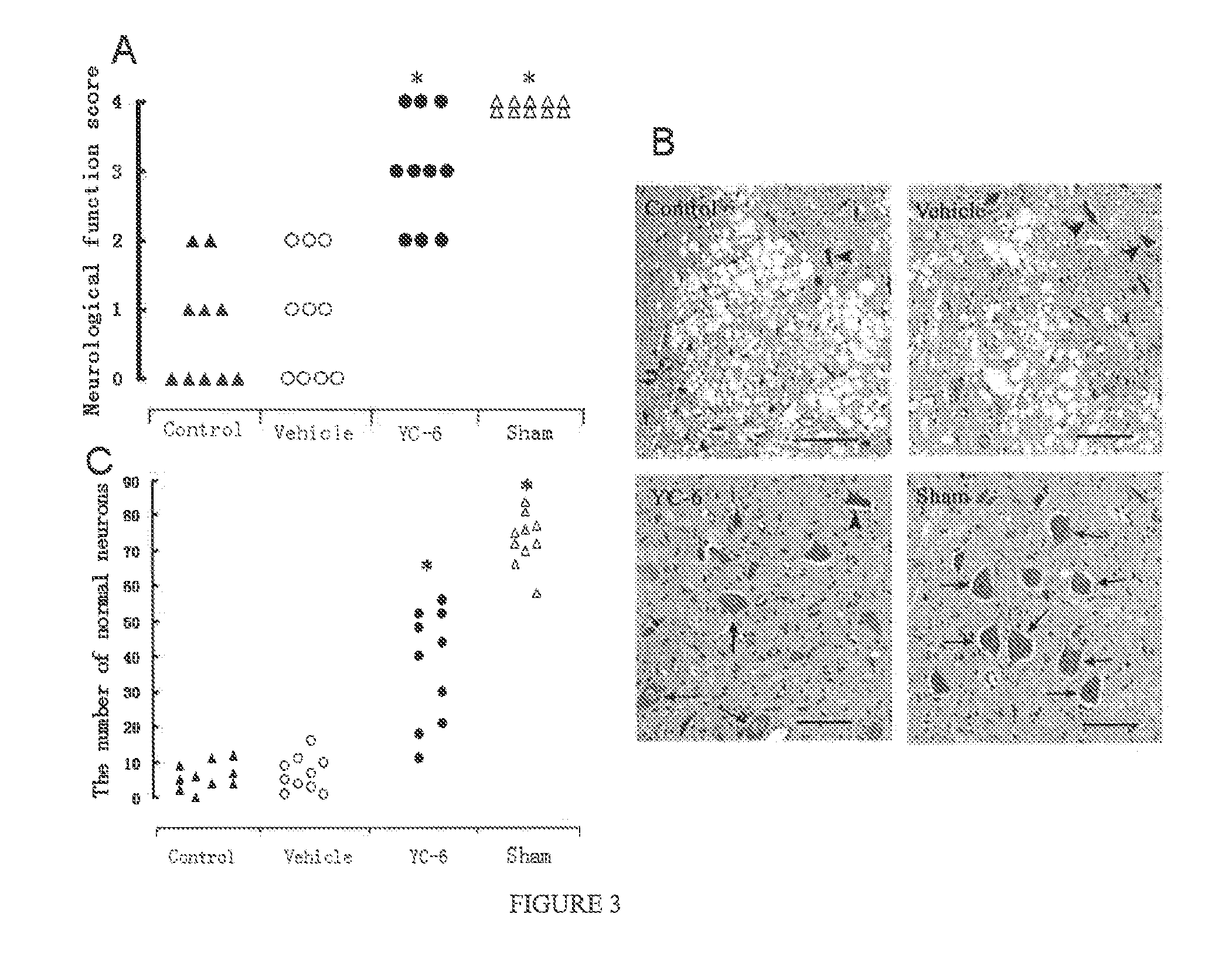 Use of 5.alpha.-androstane (alkyl)-3.beta.,5,6.beta.-triol in preparation of neuroprotective drugs