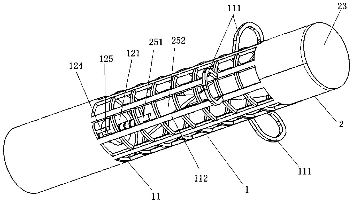 Stent replacement system suitable for urinary retention and urinary incontinence