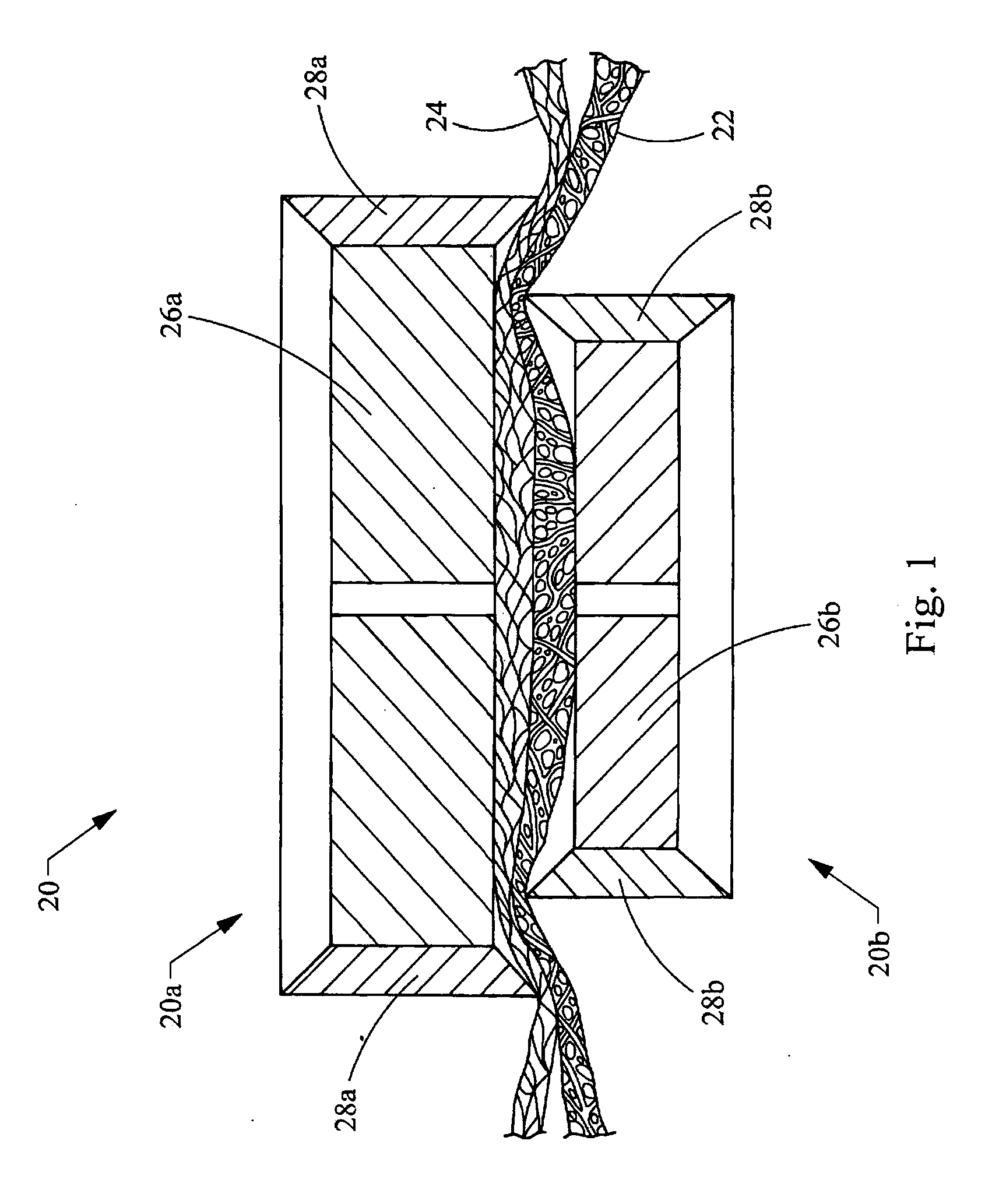 Intestinal bypass using magnets