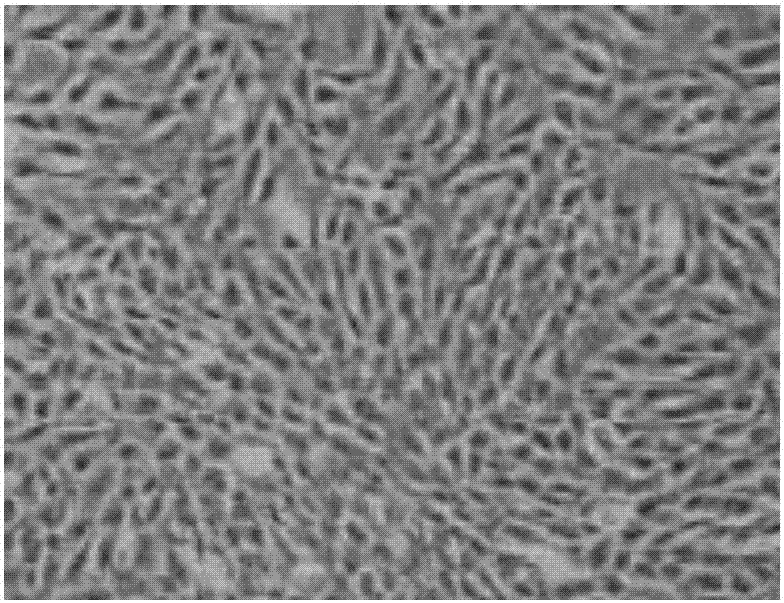 Preparation containing fibroblast exosome and application thereof