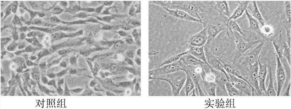 Preparation containing fibroblast exosome and application thereof