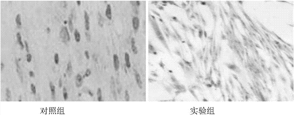 Preparation containing fibroblast exosome and application thereof