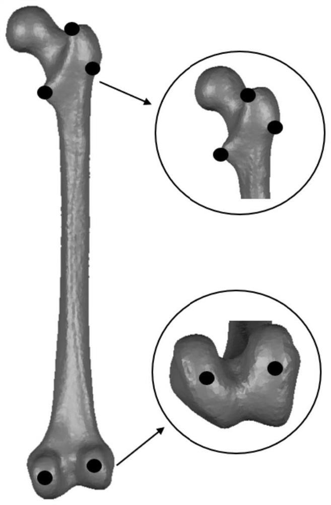 Human skeleton three-dimensional model acquisition method and system based on two-dimensional medical image