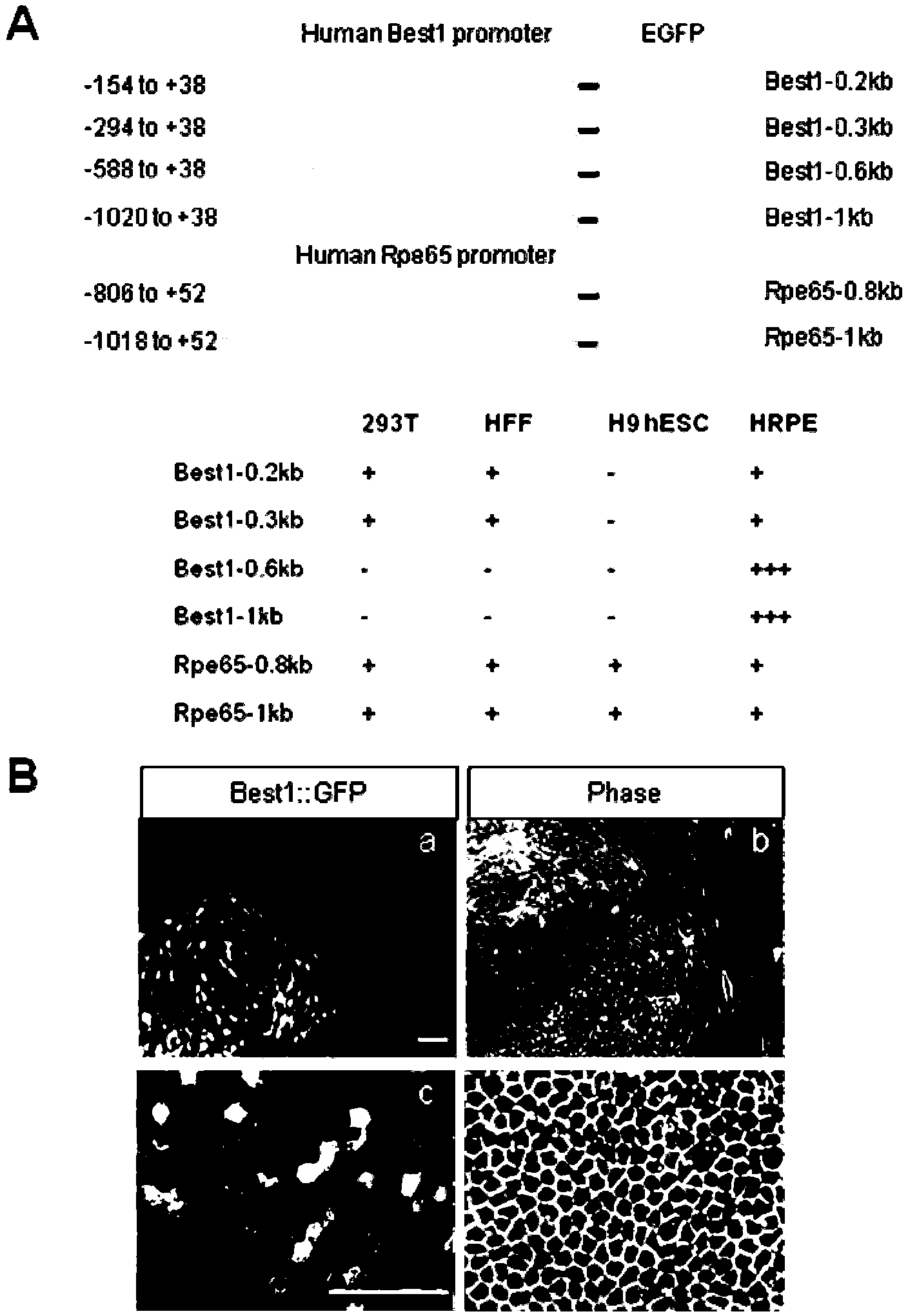 Method for transdifferentiation of human fibroblast to retinal pigment epithelium