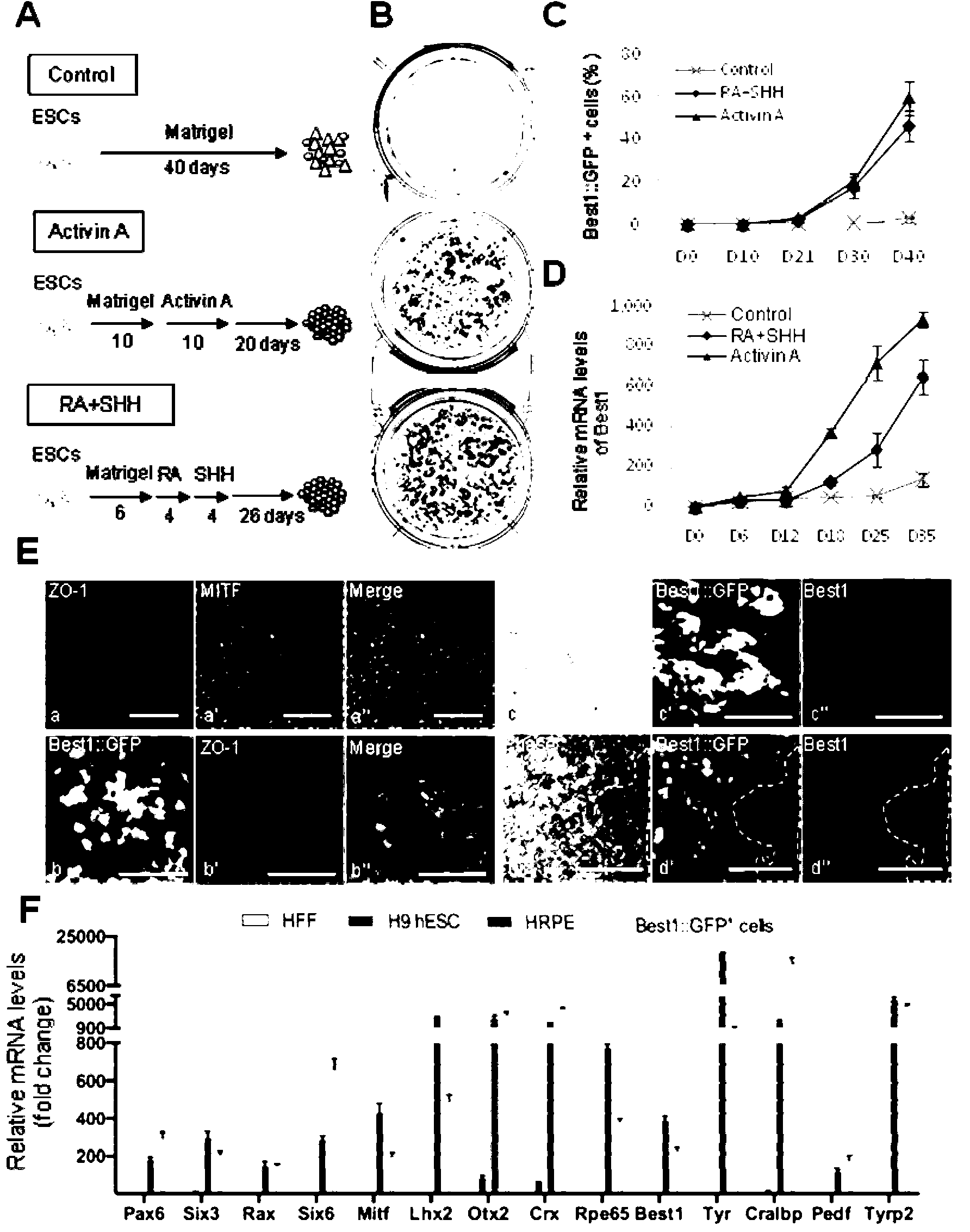 Method for transdifferentiation of human fibroblast to retinal pigment epithelium