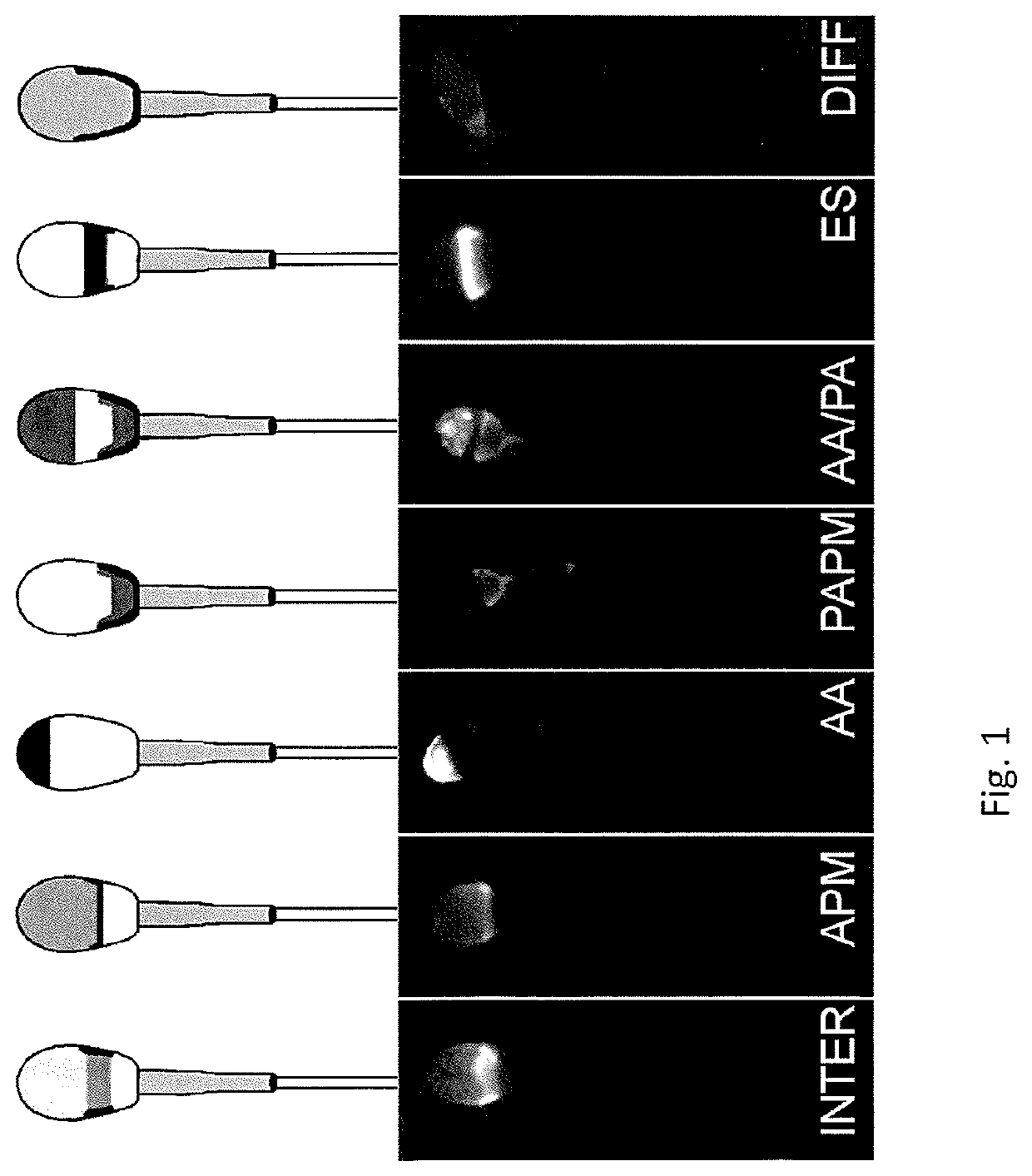 Methods and test kits for determining male fertility status