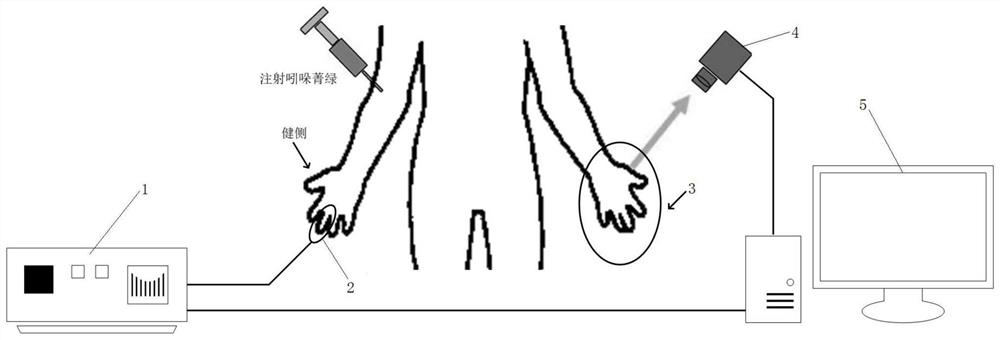 Broken limb replantation and free flap postoperative blood supply evaluation device and method