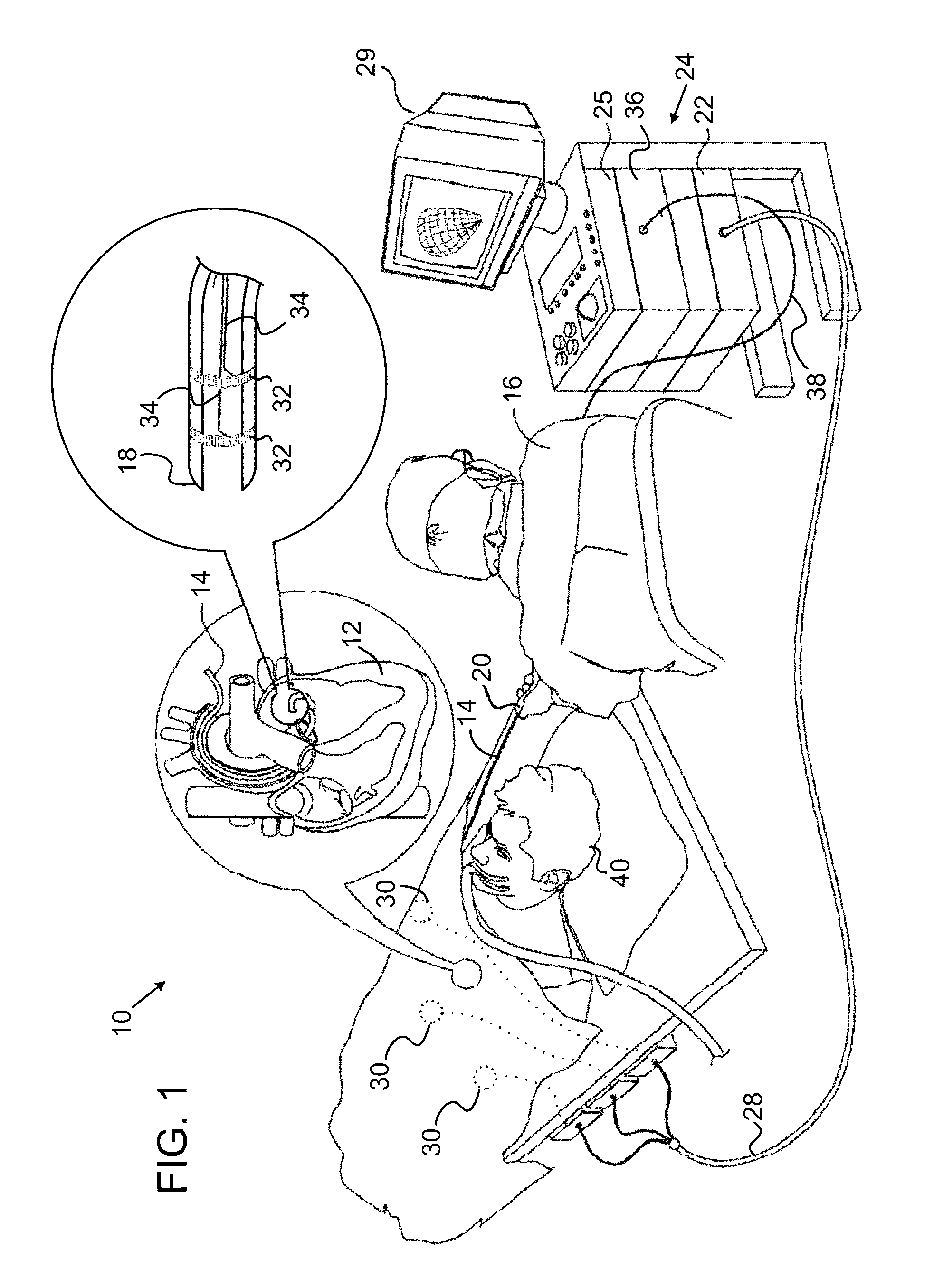 Calibration and compensation for errors in position measurement