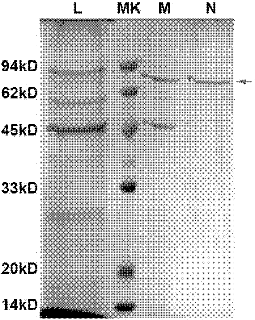 Preparation and application of Her2-neu antigen positive tumor therapeutic vaccine