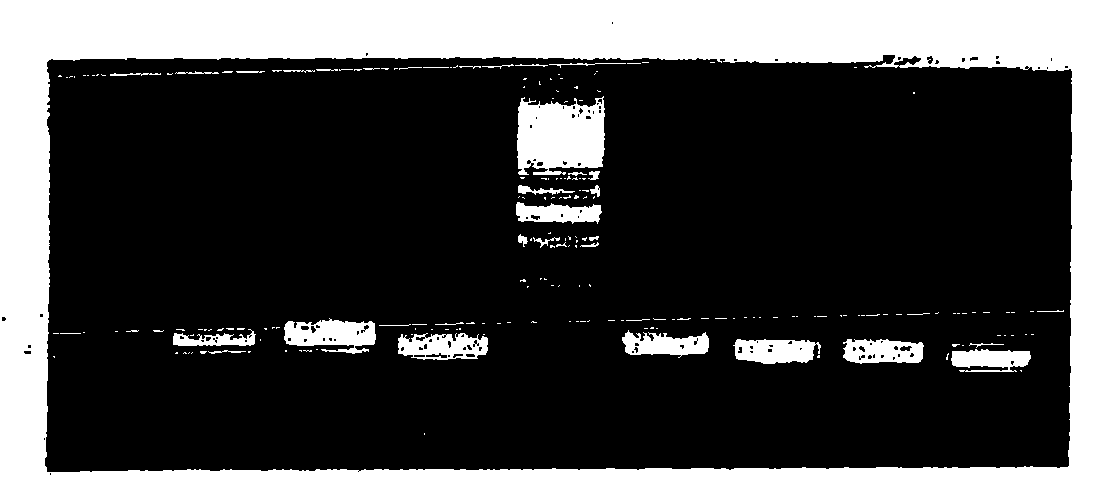 Method for production of antibody