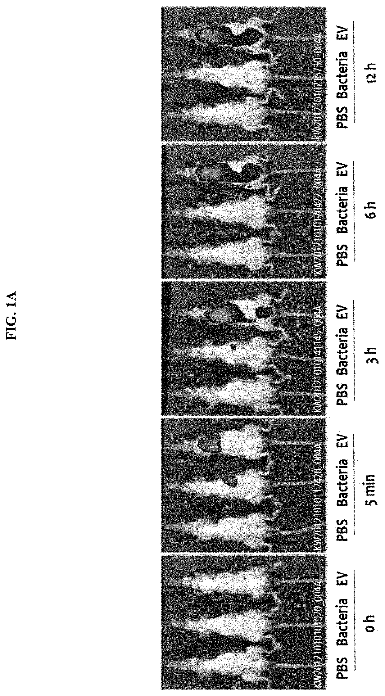 Nanovesicles derived from bacteria of genus rhodococcus, and use thereof