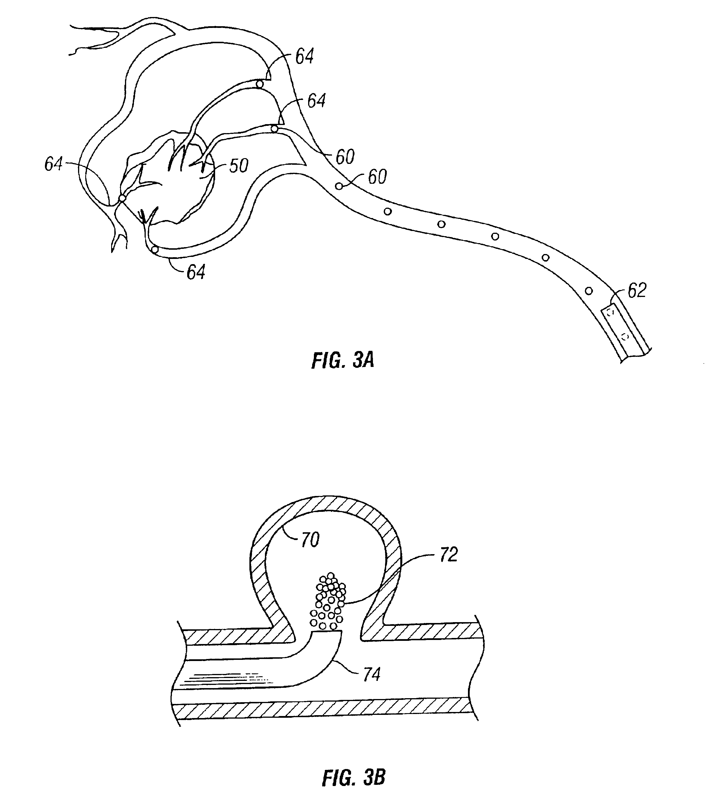 Containers and methods for delivering vaso-occluding filaments and particles