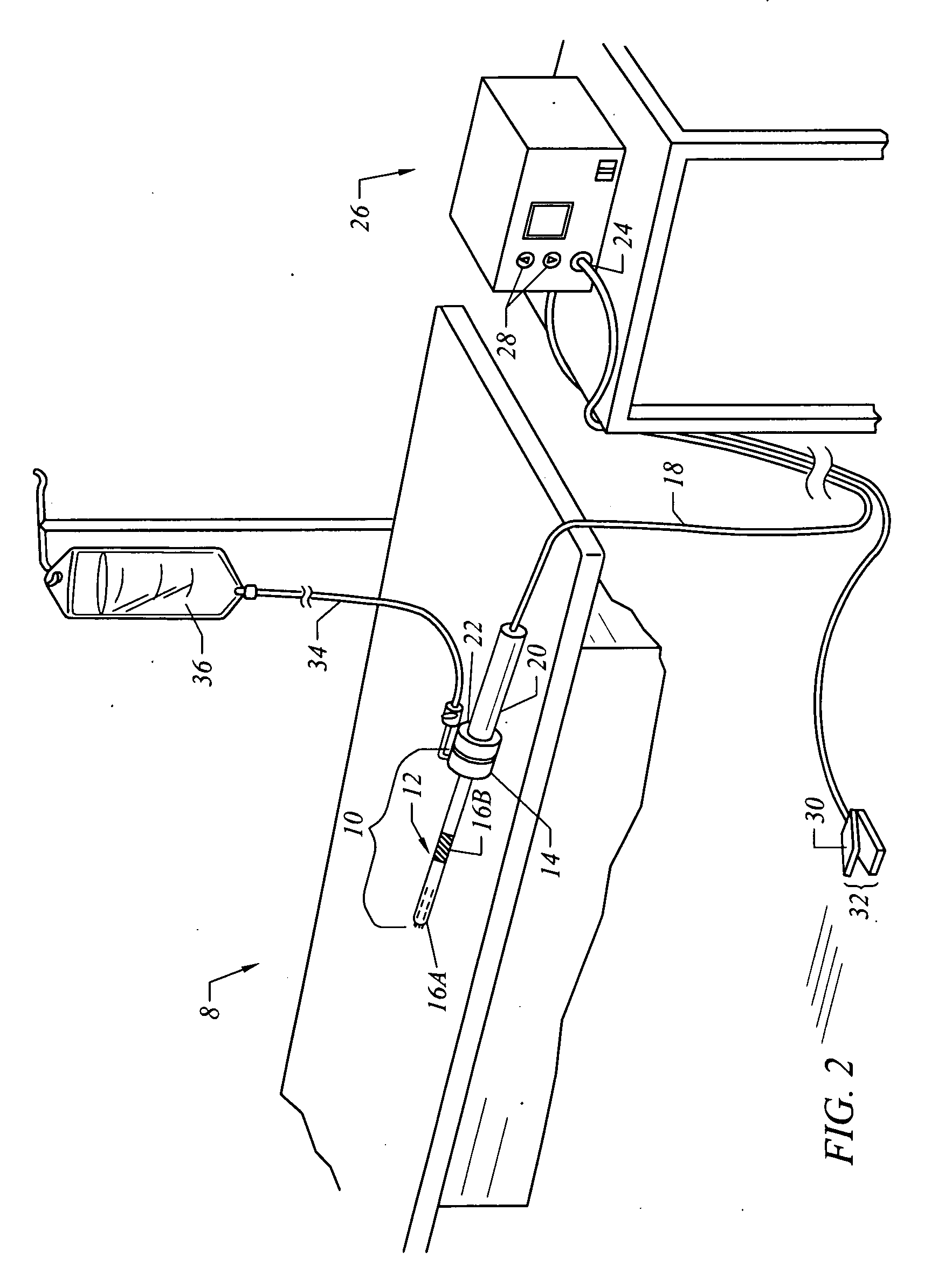 Electrosurgical method and system for treating foot ulcer