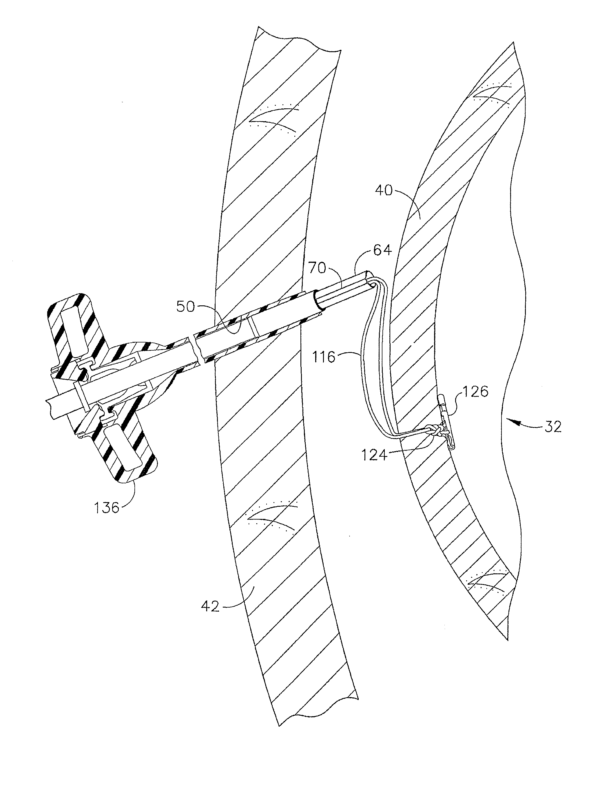 Device for insufflating the interior of a gastric cavity of a patient