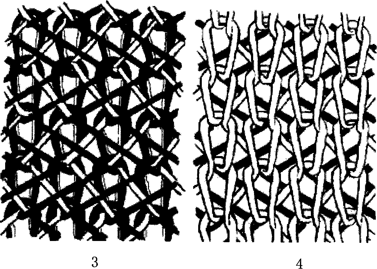 Two-layer warp-knitted tissue textile-type artificial blood vessel