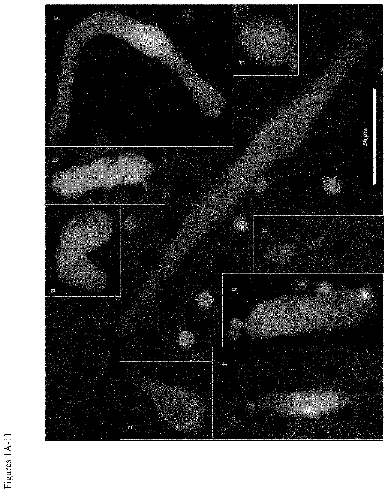 Use of circulating cell biomarkers in the blood for detection and diagnosis of diseases and methods of isolating them