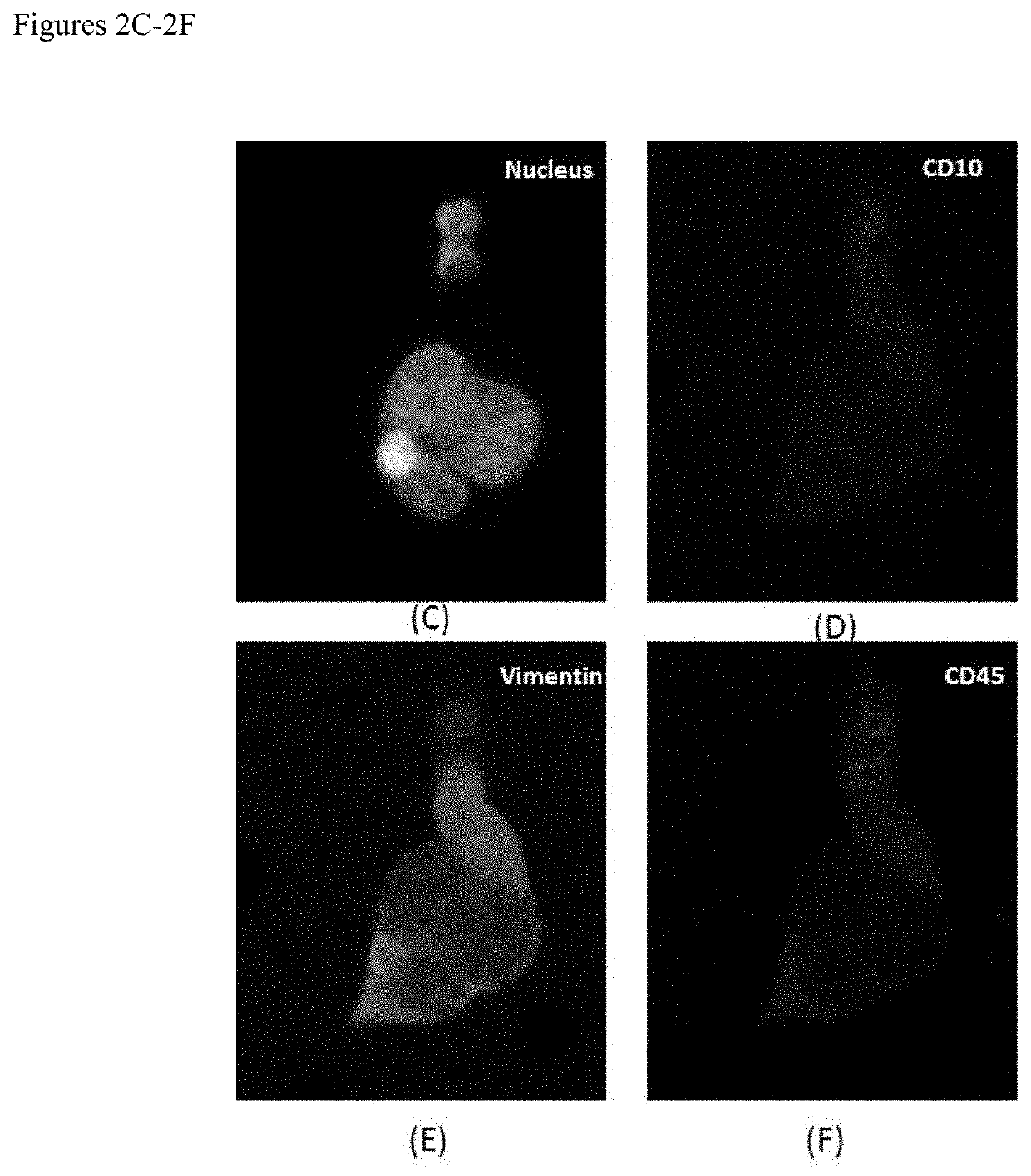 Use of circulating cell biomarkers in the blood for detection and diagnosis of diseases and methods of isolating them