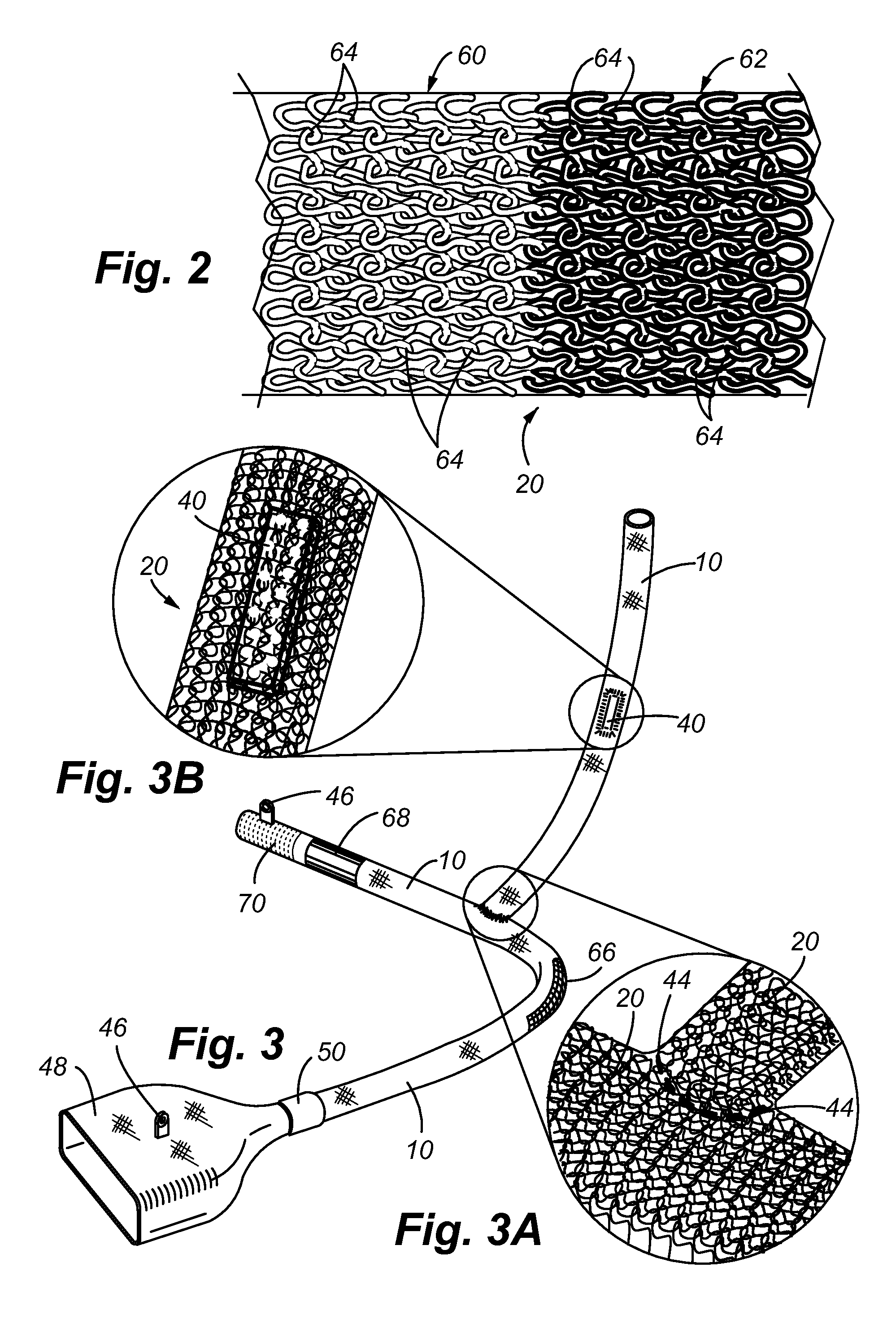 Conductive mesh for composite tube for fluid delivery system