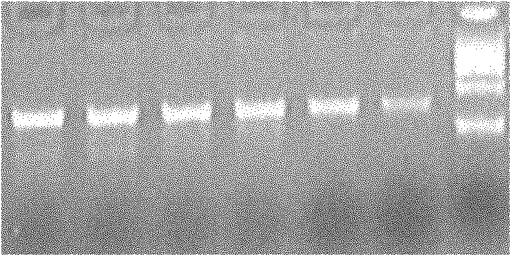 Method for detecting molecular marks of butter-fat content of Chinese Holstein by utilizing LDR technology