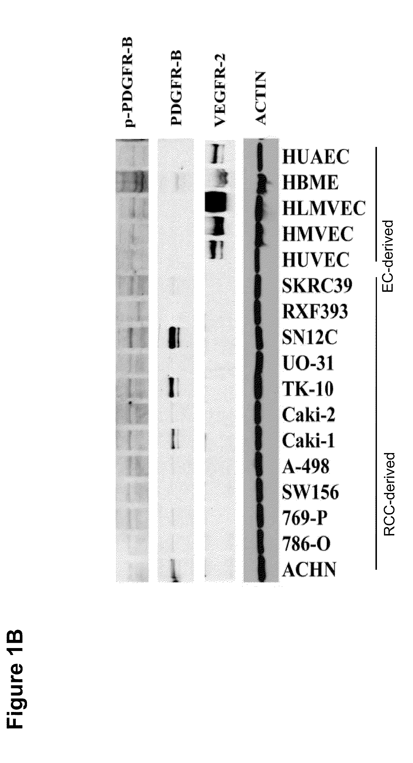 Methods for treating sunitinib-resistant carcinoma and related biomarkers