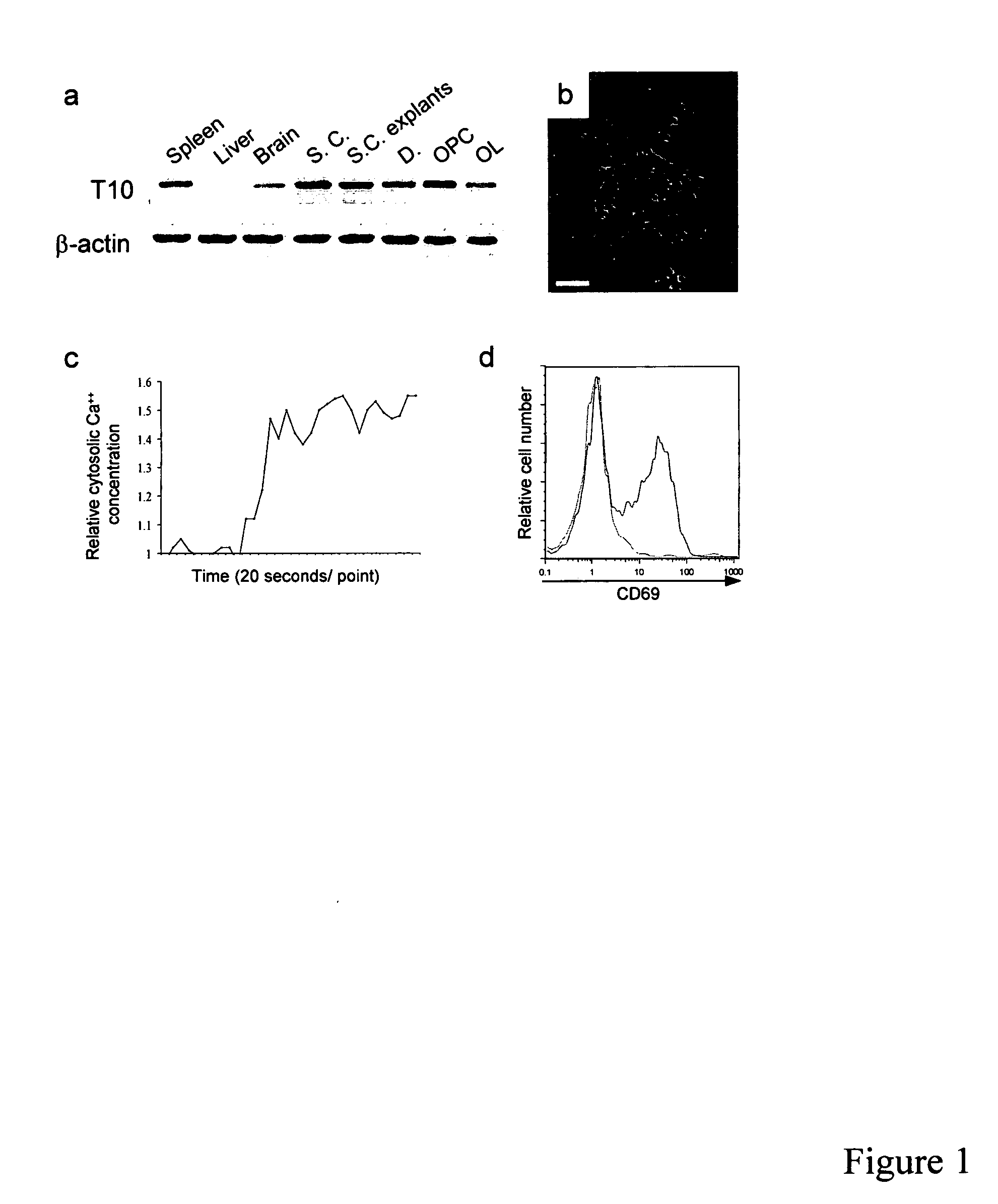 Severe myelin deficits induced by self-reactive gamma delta T cells